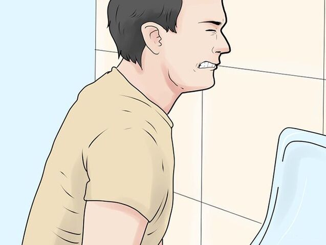 sāpīga urinēšana ar prostatītu